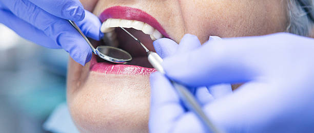 Best Emergency Dental Care for Broken or Chipped Teeth in Park City, MT